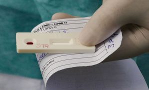 Vital Brazil e UFRJ testam soro para tratar covid 19 Leopoldo Silva Agência Brasil