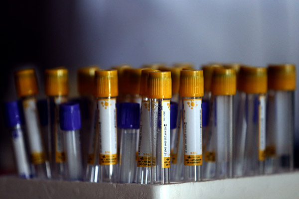 Estado do Rio tem dois novos casos confirmados de Influenza Aviária em aves silvestres